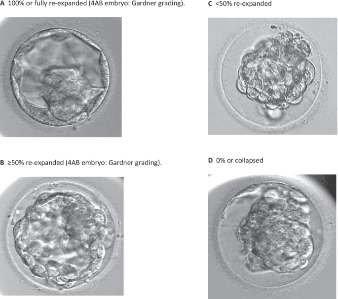 Embryo Thaw Issues